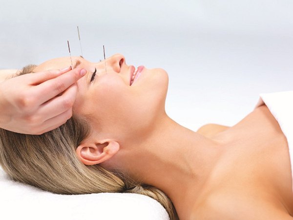 acupuntura facial vigo