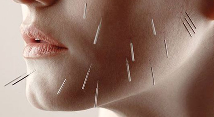 Beneficios del tratamiento: Acupuntura facial Taiyang 0